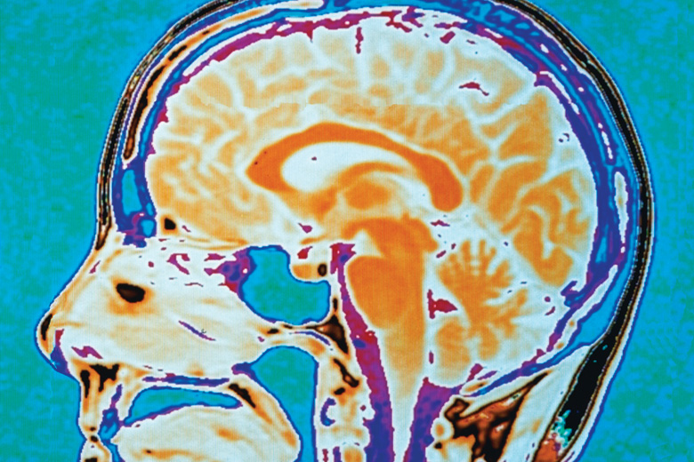 Close-up of human brain scan Close-up of human brain scan