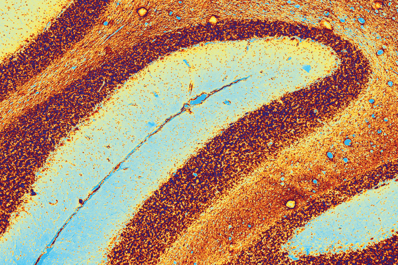 Coloured light micrograph of section through cerebellum of brain Coloured light micrograph of section through cerebellum of brain