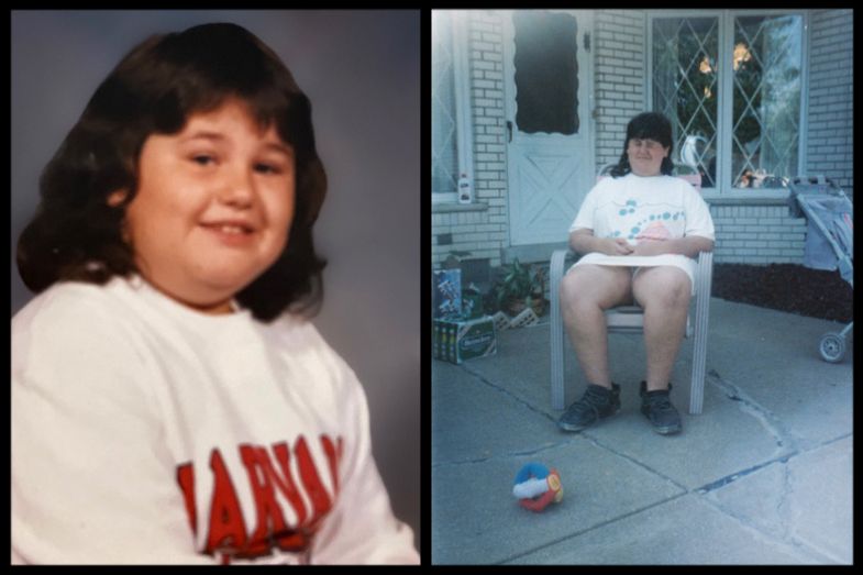 Childhood pictures of Georgiann Davis. Aged approximately 7 years old in 1987 (left) and aged approximately 13 years old in 1993 (right). Childhood pictures of Georgiann Davis. Aged approximately 7 years old in 1987 (left) and aged approximately 13 years old in 1993 (right).