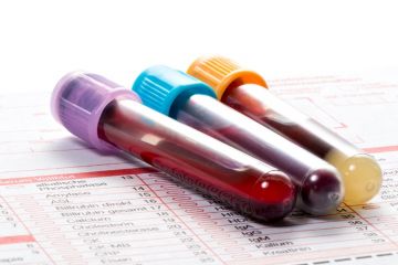 Medical research
