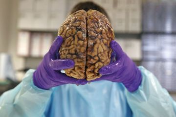 Brain