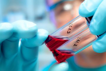 Person holding blood samples in test tubes Person holding blood samples in test tubes