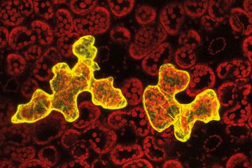 Plant virus Plant virus