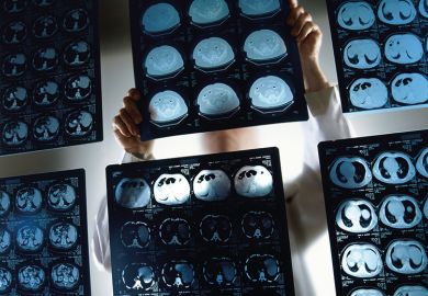 brain-scans brain-scans