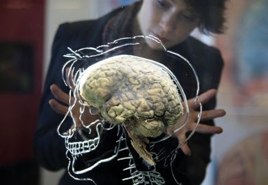 human brain Human brain