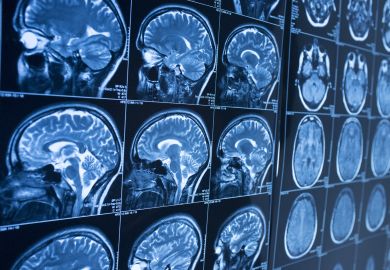 Brain scan Brain scan