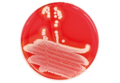 Close-up of petri dish