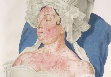 skin disease woman skin disease woman