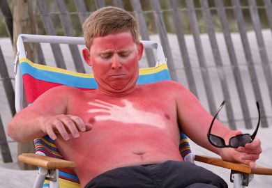 A sunburned man
