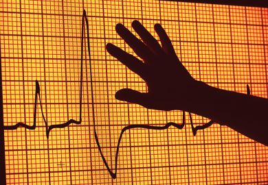An image from an electrocardiogram