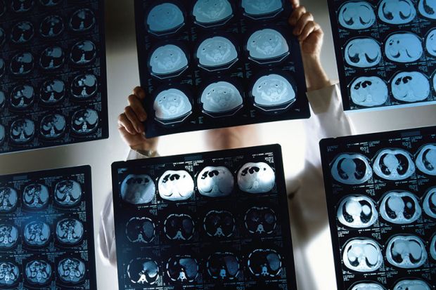 brain-scans brain-scans